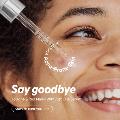 Azelaic Acid 12% Serum