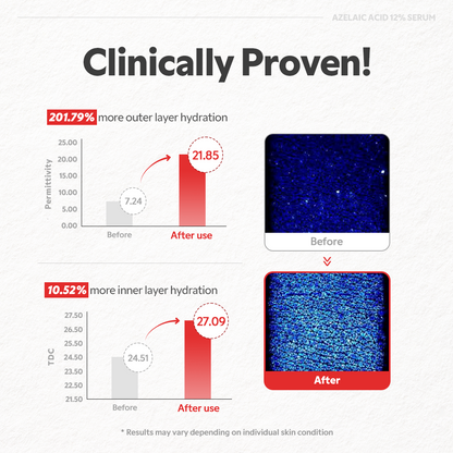 Azelaic Acid 12% Serum